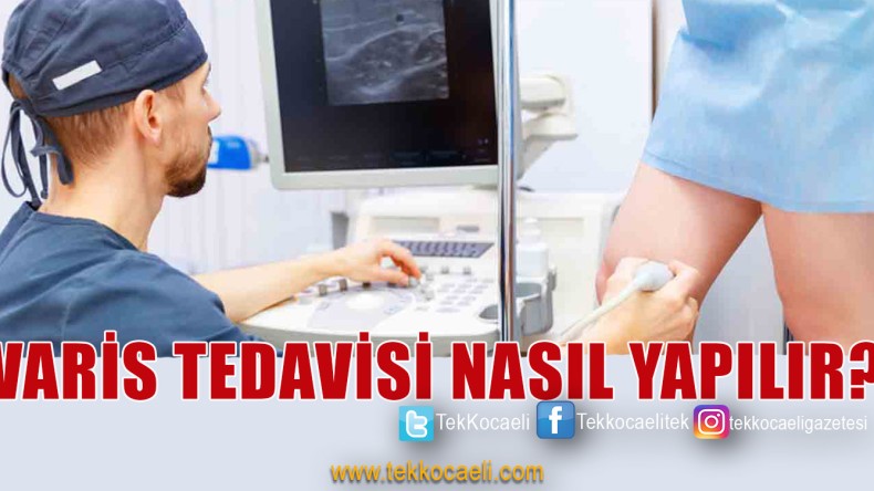 Varis Belirtisi ve Tedavi Yöntemleri Nelerdir?