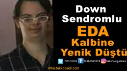 Down Sendromlu Eda, Vefat Etti