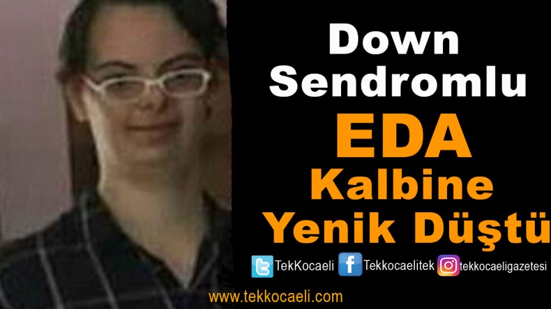 Down Sendromlu Eda, Vefat Etti