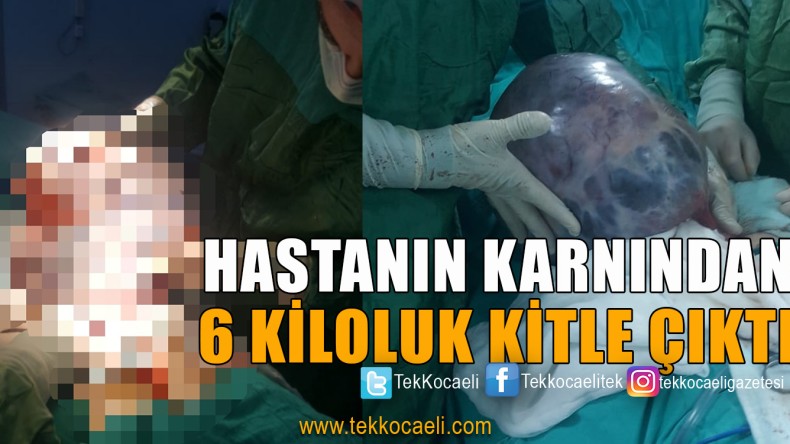 Karnından 6 Kilo Ağırlığında Kitle Çıkarıldı