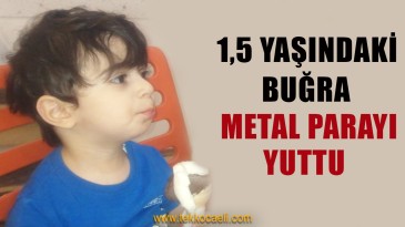 1,5 Yaşındaki Çocuk Metal Parayı Yuttu