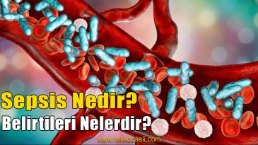 Kocaeli İl Sağlık, Sepsis Hastalığına Dikkat Çekti