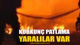 Fabrikada Korkunç Yangın; Yaralılar Var
