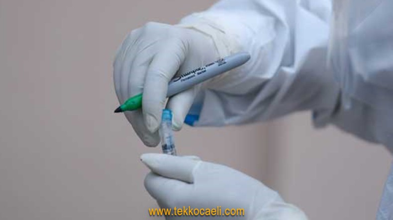 Bilim Kurulu Üyesi Açıkladı; Yeni Tedbirler…