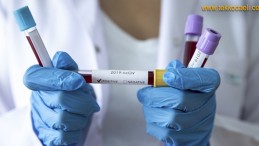 Kocaeli’de Koronavirüs Şoku