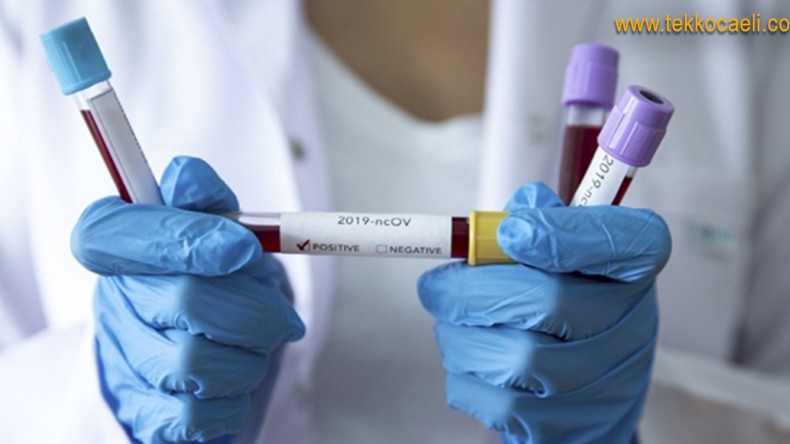 Kocaeli’de Koronavirüs Şoku