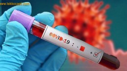 Sağlık Bakanlığı’ndan 81 İl’e Yeni Korona Genelgesi