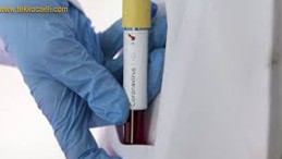 Korona’da 2. Dalganın Geleceği Tarihi Açıkladı