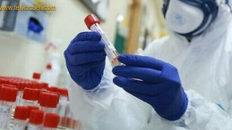 Son 45 Günün En Yüksek Vaka Sayısına Ulaştık