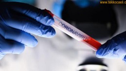 Kötü Haberler Geliyor; İşçilerde Korona Çıktı