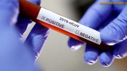 Koronavirüs’te Son Rakamlar Açıklandı