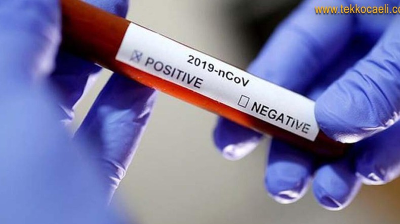 Koronavirüs’te Son Rakamlar Açıklandı