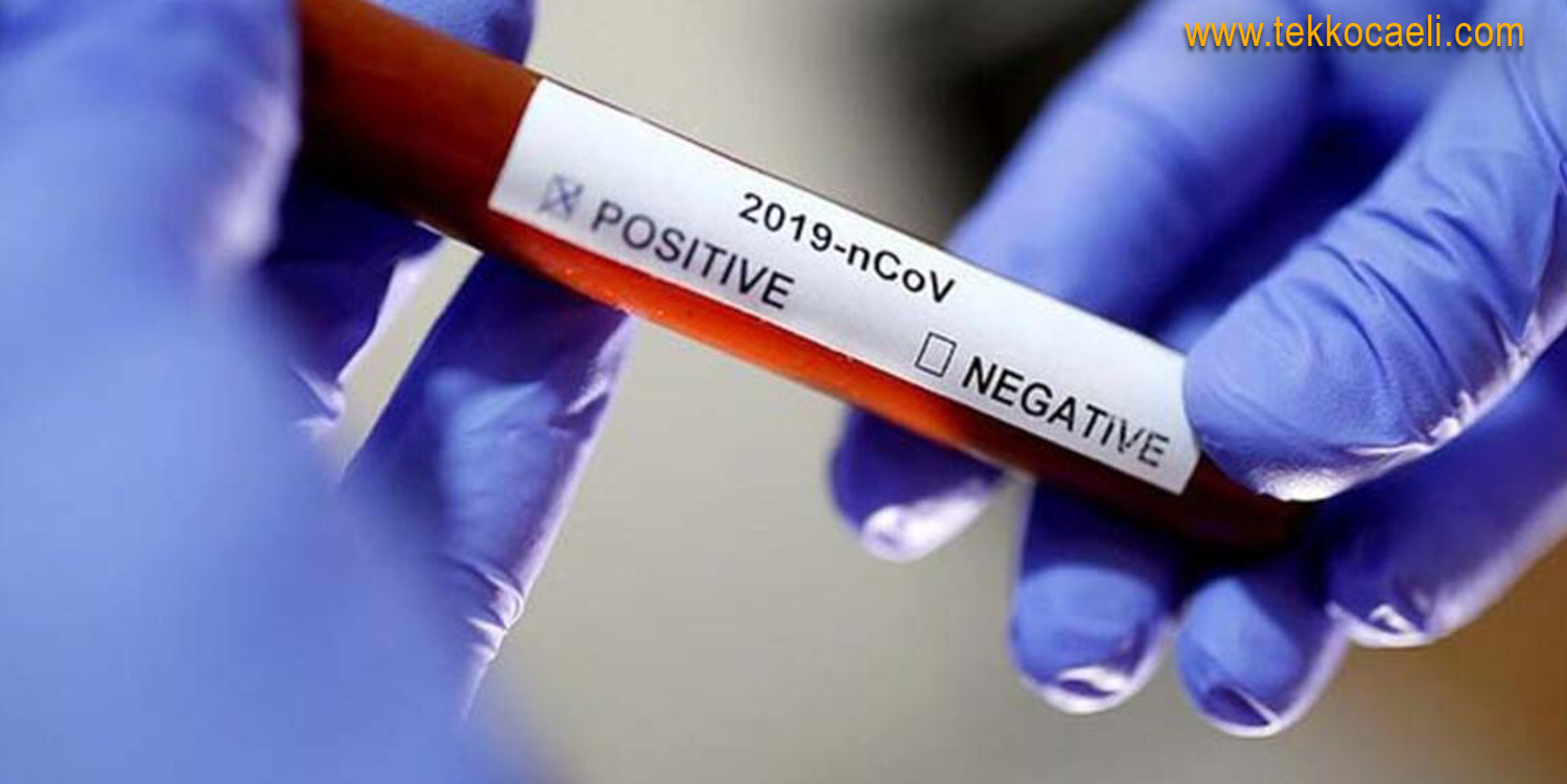Koronavirüs’te Son Rakamlar Açıklandı