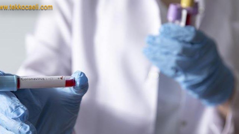 Koronavirüs Verileri Açıklandı; İşte Son Rakamlar