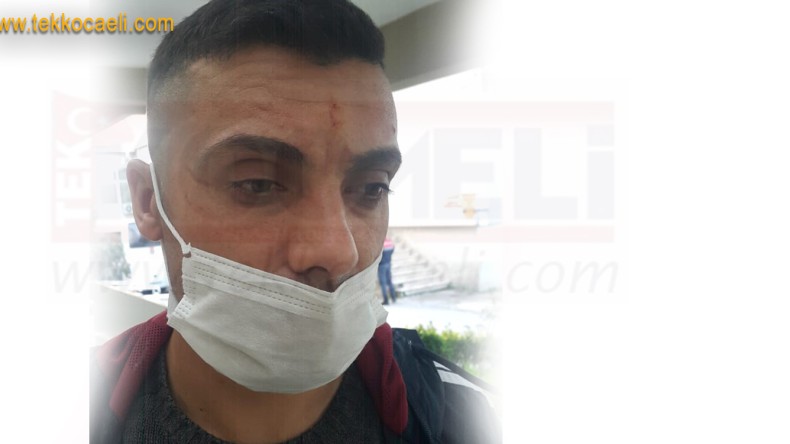 Annesiyle Telefonda Kürtçe Konuşan Şahıs Darp Edildi