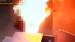 Eşinin Üzerine Benzin Döküp Ateşe Verdi