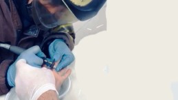 Parmağından Yüzüğü İtfaiye Ekipleri Çıkardı