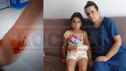 İzmit Akpınar’da Köpekler Korkutuyor; Yine Saldırdı