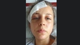 Eski Koca Dehşet Saçtı; Bıçak Çekti, Yumrukladı