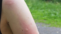 Dikkat! Ölümcül Olabilir; Marmara’da Görüldü