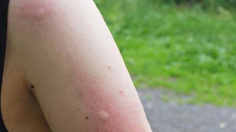 Dikkat! Ölümcül Olabilir; Marmara’da Görüldü