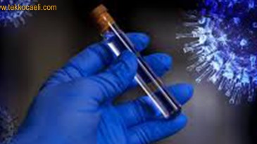 Haritayı Paylaştı; Kocaeli’de Vakalarda Artış