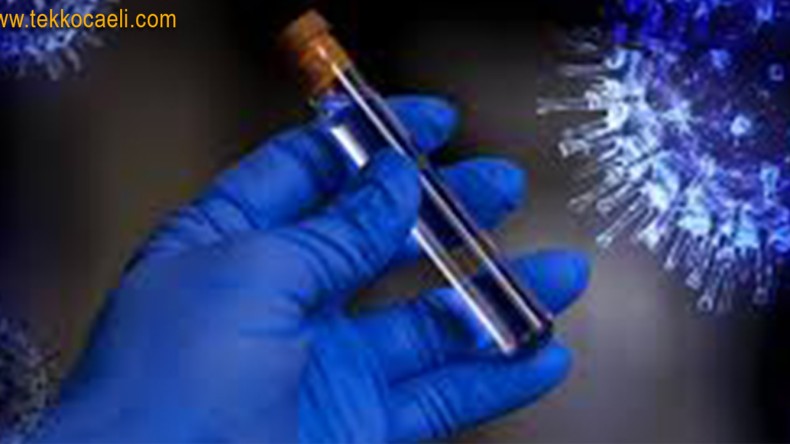 96 Can Daha Kaybettik; İşte Tablo…