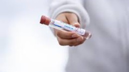 Korona’da Gelişme; İşte Detaylar…