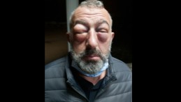 Öldüresiye Dayak Attılar; 1 Kişi Tutuklandı