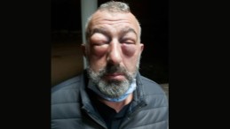 Kocaeli’de Korkunç Olay; Öldüresiye Dövdüler