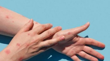 Korkulan oldu; Türkiye’de görüldü, dikkat!