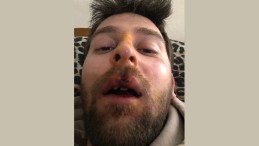 Scooter’a binen genç büyük kaza atlattı; ailesi yetkililere seslendi