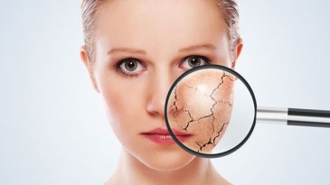 Hava sıcaklıkları artıyor, cilt kuruluğu olanlar dikkat! İşte önlemler…