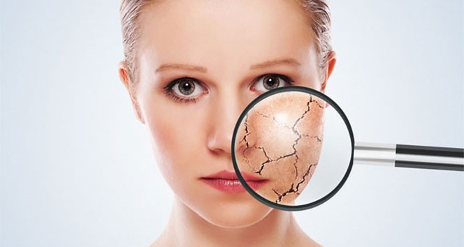 Hava sıcaklıkları artıyor, cilt kuruluğu olanlar dikkat! İşte önlemler…