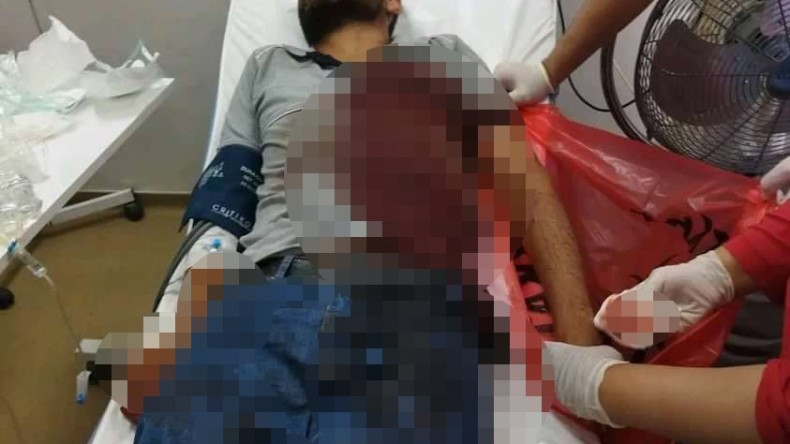 Elektrik sayacı okuyan personele köpek saldırdı