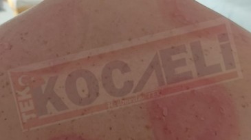 Kocaeli Şehir Hastanesi’nde inanılmaz olay: Hastayı lazer odasında unuttular