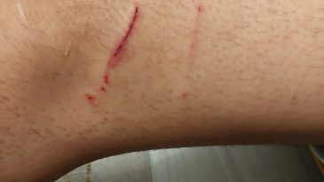 Tramvay durağında köpekler saldırdı, canını zor kurtardı