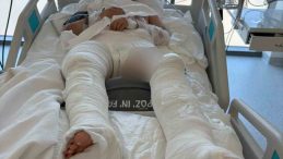 Otomobilin çarptıktan sonra üzerinden geçtiği genç kız ağır yaralandı