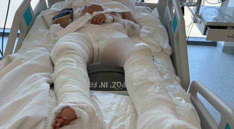 Otomobilin çarptıktan sonra üzerinden geçtiği genç kız ağır yaralandı