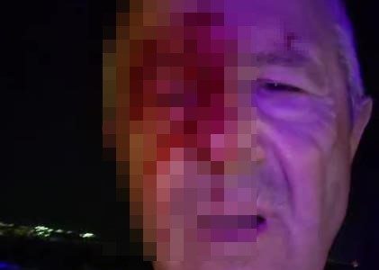 Saldırıya uğrayan muhabir sahada yalnız bırakıldı
