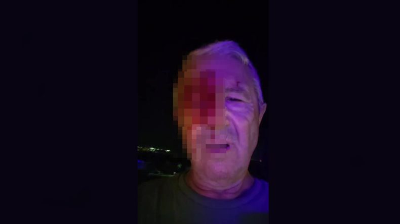 Haber yapmak için olay yerine giden muhabire saldırı