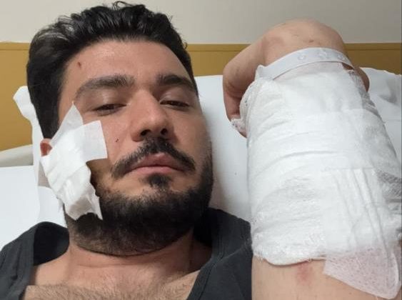 Muşta ile darbettiği iddia edilen taraftan açıklama geldi: “Müvekkilim kesinlikle muşta kullanmamıştır”