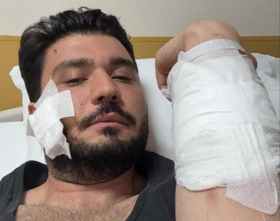 Muşta ile darbettiği iddia edilen taraftan açıklama geldi: “Müvekkilim kesinlikle muşta kullanmamıştır”