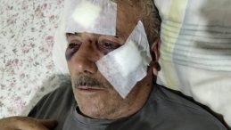 İnek tartışması kanlı bitti! Lise öğretmeni yaşlı komşusunu muştayla darbetti