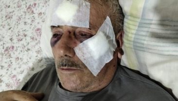 İnek tartışması kanlı bitti! Lise öğretmeni yaşlı komşusunu muştayla darbetti